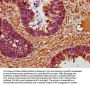 CCND2 Antibody