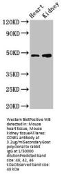 CCNE1 Antibody