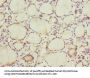 CCNE2 Antibody