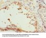 CCNE2 Antibody