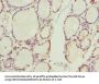 CCNE2 Antibody