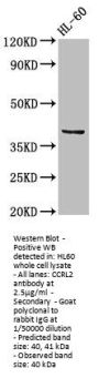 CCRL2 Antibody