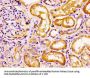 CCRL2 Antibody