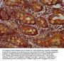 CCS Antibody