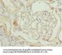 CCT2 Antibody