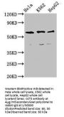 CCT5 Antibody