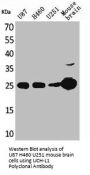 UCHL1 Antibody