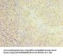 CD22 Antibody