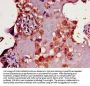 CD33 Antibody