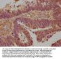 CD81 Antibody