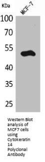 Cytokeratin 14 Polyclonal Antibody