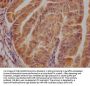 CDK6 Antibody