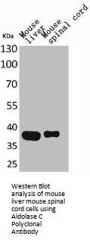 Aldolase C Polyclonal Antibody