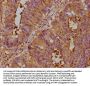 CEACAM5 Antibody