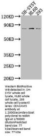 CEACAM5 Antibody
