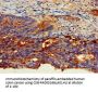 CEACAM6 Antibody