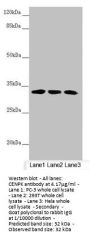 CENPK Antibody