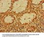 CERK Antibody