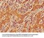 CERK Antibody