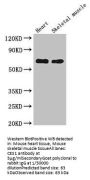 CES1 Antibody
