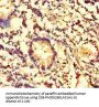 CES3 Antibody