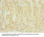 CHAD Antibody