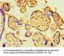 CHD1 Antibody