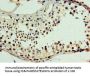 CHD2 Antibody