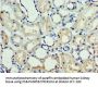 CHD2 Antibody