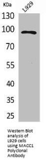 MACC1 Antibody