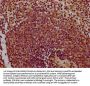 CHODL Antibody