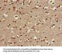CHST1 Antibody