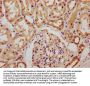 CHSY1 Antibody