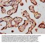 CHSY1 Antibody