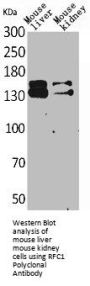 RFC1 Antibody