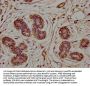CLCN5 Antibody