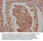 CLCN6 Antibody