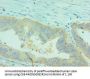 CLDN2 Antibody