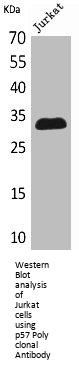 CDKN1C Antibody