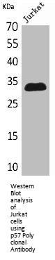 CDKN1C Antibody