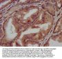 CLN5 Antibody