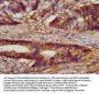 CLN5 Antibody