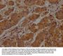 CLTC Antibody