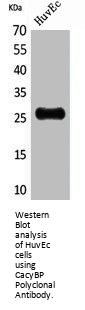 CACYBP Antibody