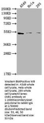 CNR1 Antibody