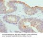 COCH Antibody