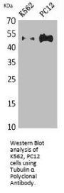 TUBA1A/TUBA1B/TUBA1C/TUBA3C/TUBA4A Antibody