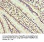 Rabbit anti-human Collagen alpha-1(II) chain polyclonal Antibody(COL2A1)