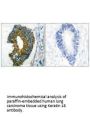 KRT18 Antibody