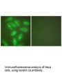 KRT18 Antibody